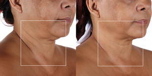 Anti-Aging-Gerät – Pro Skincare Deluxe Feuchtigkeitsset