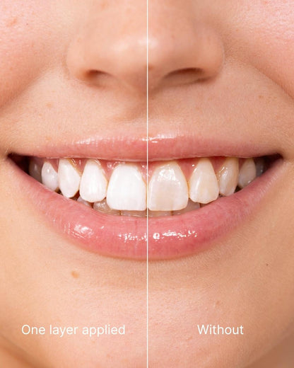 ODALIT™ Teeth Polish - Instant White Teeth-Limited Time 75%OFF Buy 1 Get 1 Free 🔥LAST DAY⏰