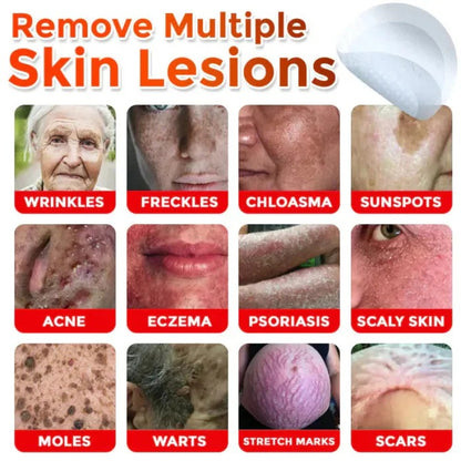 NEGUSY™ Removal Patch: Gentle Microneedle Patches for SkinTag & Mole Removal