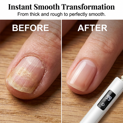 💅 Professional Electric Nail Drill Kit | Effortless Gel Removal & Salon Shaping at Home ✨